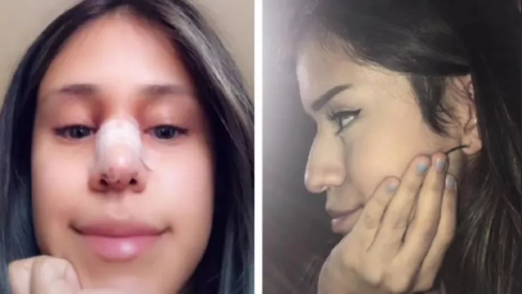 Perdona infidelidad a cambio de cirugía plástica