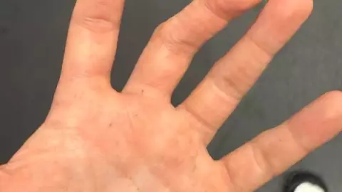 dedo lesionado Santiago Gimenez copa oro méxico