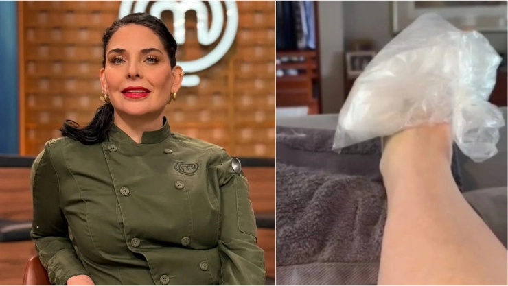 MasterChef Zahie lesión pie.jpg