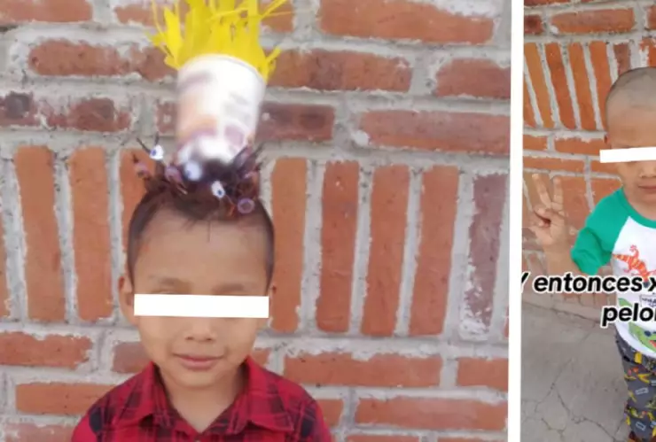 Niño se queda calvo por peinado loco