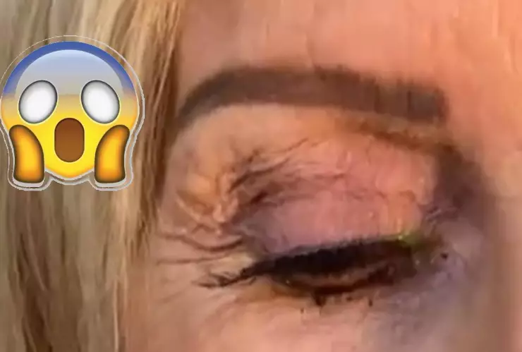 Le sacan 23 lentes de contacto a una mujer