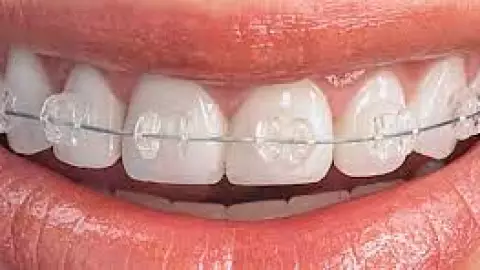 NASA, inventos, objetos cotidianos C.jpg