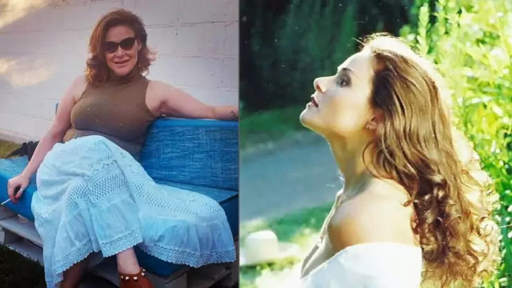 Ex reina de belleza murió tras complicaciones en cirugía estética