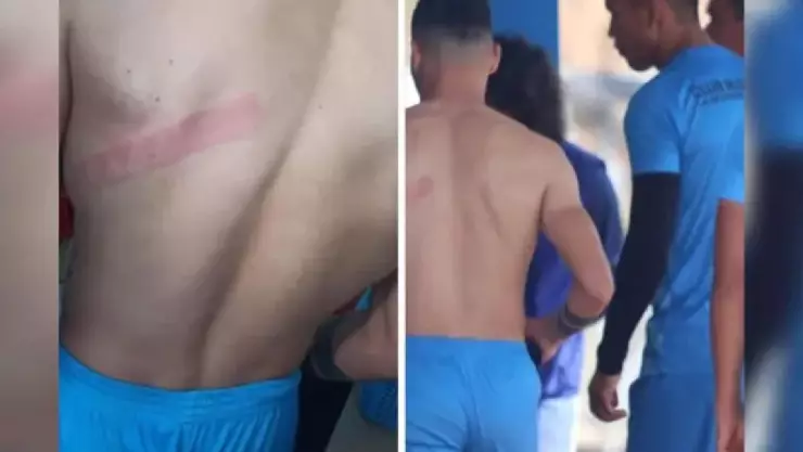 Hinchas golpean con cinturón a futbolistas tras malos resultados