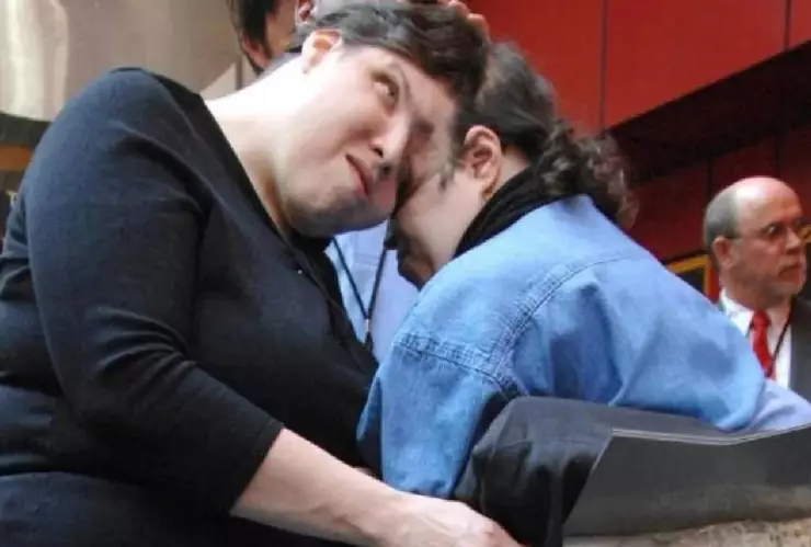 Fallece Lori y George Schappell, los siamesas más viejas del mundo; esto se sabe.jpg