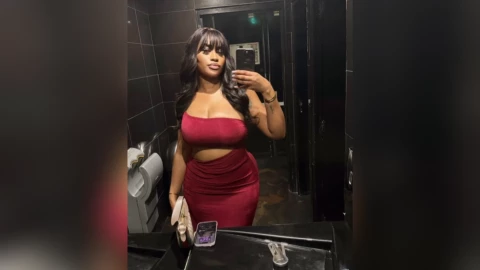 Tras someterse a cirugía estética en Turquía, muere la influencer Ngoye Ndiaye .png