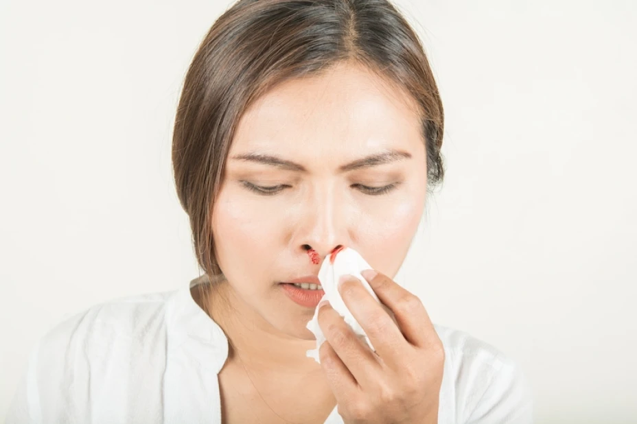 Sangrado nasal