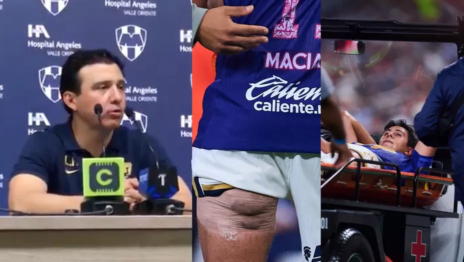 revelan lesion de jose juan macias pumas