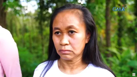 Progeria, joven, anciana b.jpg