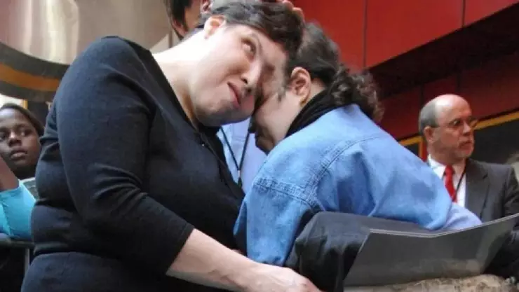 Fallece Lori y George Schappell, los siamesas más viejas del mundo; esto se sabe.jpg