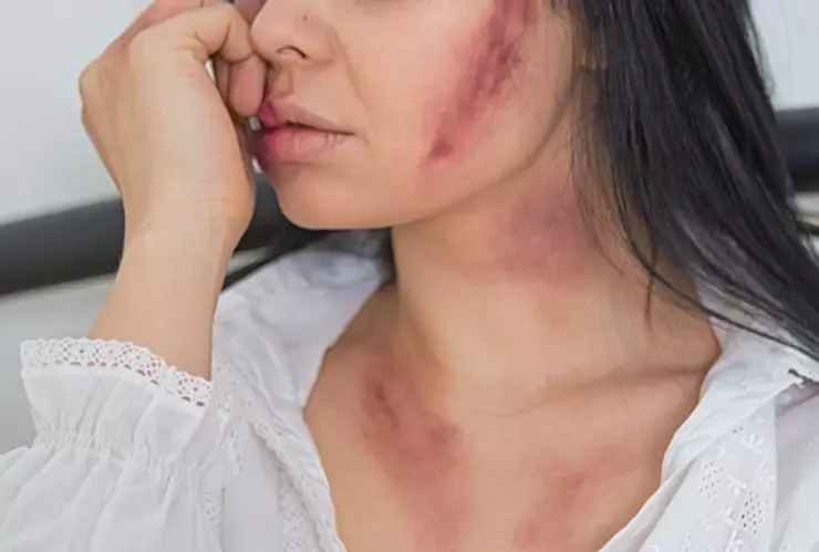 mujer es asesinada a golpes san andrés cholula