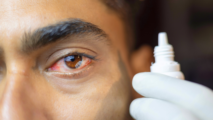 Hombre pierde su ojo izquierdo por parásito