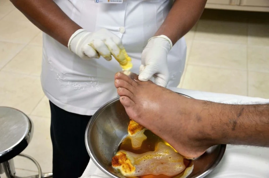 Pie diabético