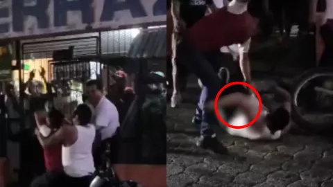 Graban VIDEO del momento en que un hombre se rompe el brazo en plena pelea callejera y se le sale el hueso