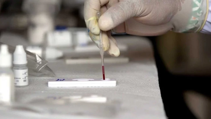 Hepatitis Aguda ¿Qué es y sus síntomas? 