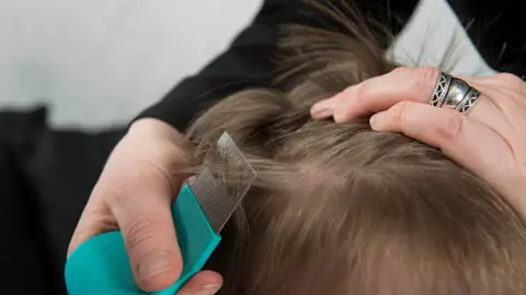 ¡No te lo imaginas! Este es el SIGNIFICADO de soñar con piojos en la cabeza