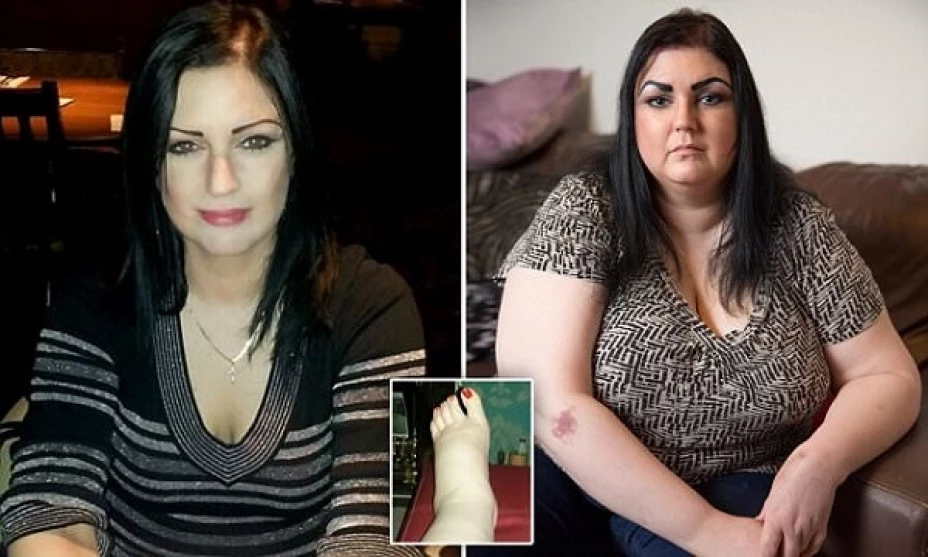 Los médicos no encuentran explicación para el aumento de peso de Laura