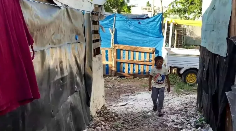 Así es como Matías sobrevive al Síndrome Treacher Collins