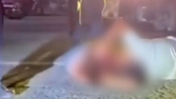 Imágenes sensibles: Arrancones dejan a mujer sin la mitad del rostro y su novio la ayuda