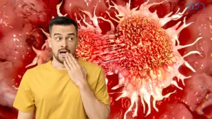  cáncer de ano.jpg 