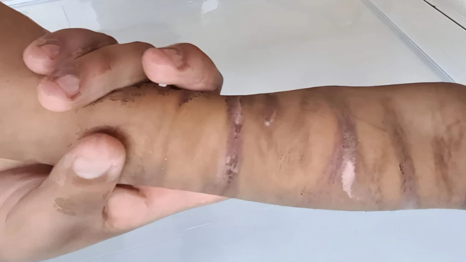 Caso de maltrato infantil en Puerto Aventuras: Niño era brutalmente torturado por sus padres
