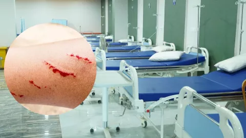 Confirman caso de rabia humana en adolescente 17 años en Zacatecas.jpg