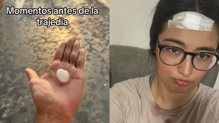 Granizo descalabra a mujer en Nuevo León.jpg