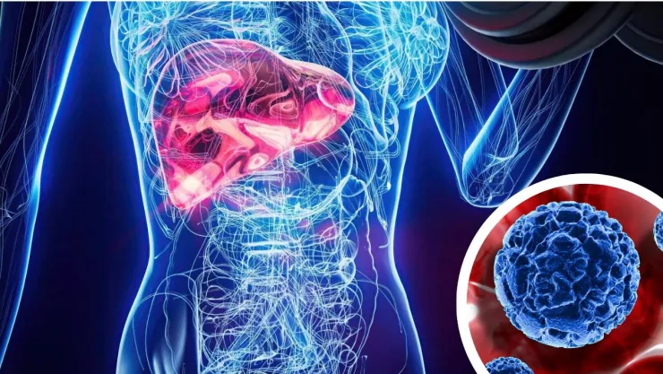 Células zombi: alerta por daño hepático y cómo prevenir