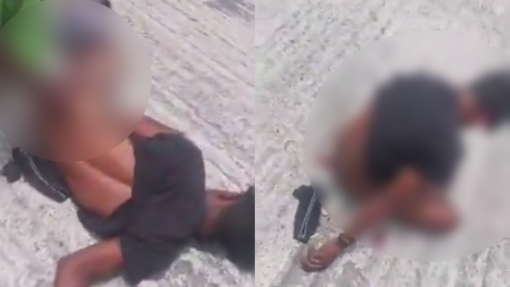 Brasil amputación genital