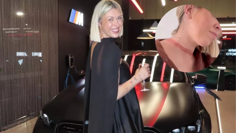 Famosa influencer casi muere estrangulada por su bufanda; ¿cómo ocurrió?