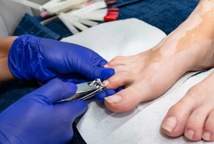 Forma correcta de cortarse las uñas de los pies