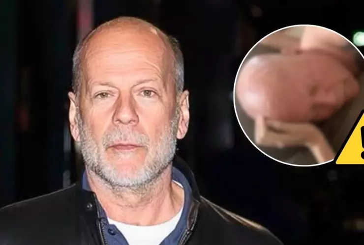 La esposa del actor reveló que su salud atraviesa una etapa crítica y la familia ya tomó decisiones difíciles