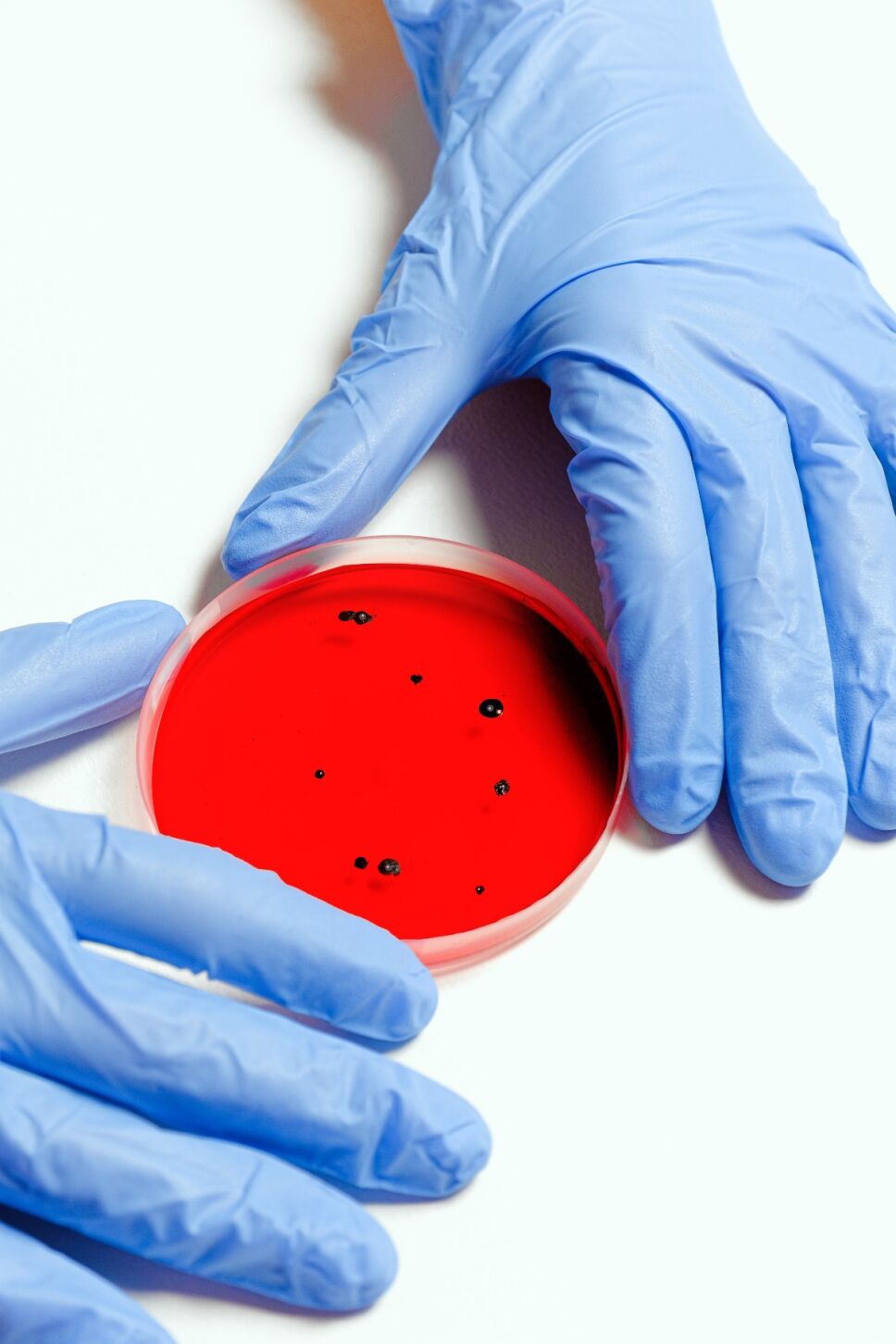 microbios vampiros