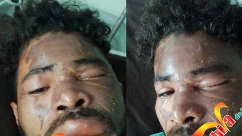 Novia quema con aceite a su novio.