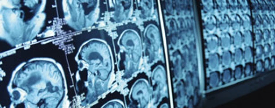 Cerebro