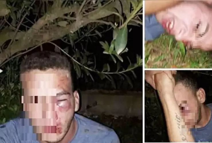 Dan golpiza a hombre tras intentar tener cita con una niña de 12 años