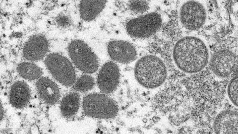 OMS declara fin de la emergencia sanitaria por viruela del mono