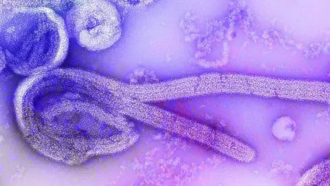 ¿Qué es el virus de Marburgo y cuáles son los síntomas?