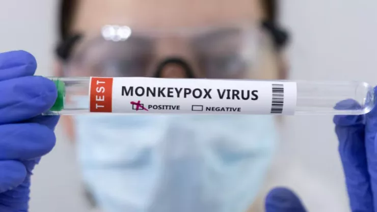 Mpox Virus del mono en Jalisco 3 casos México controlados