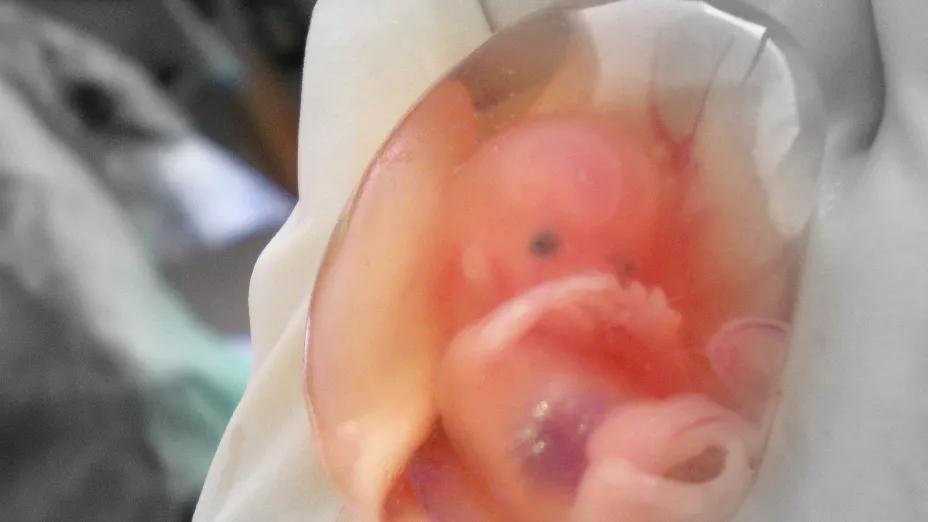 aborto