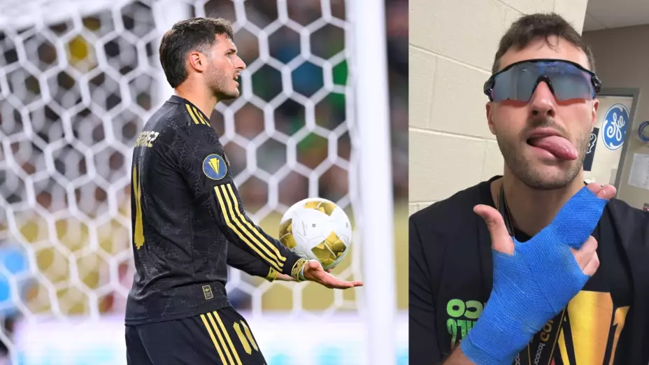 Santiago Gimenez lesión Copa Oro 2025