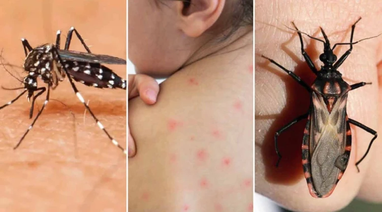 Día Mundial de la Enfermedad de Chagas_ ¿Qué causa este _padecimiento silencioso