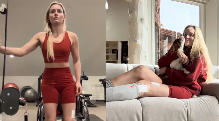 lindsey-vonne-se-revento-rodilla-casi-amputan-pierna-prepara-recuperacion
