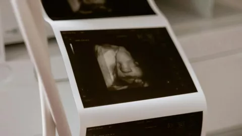 Embarazo múltiple extremo en Egipto: alerta de especialistas