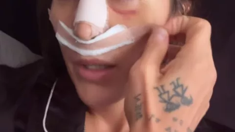 Exatlón México: ¿Cómo está Paulette Gallardo tras su cirugía?