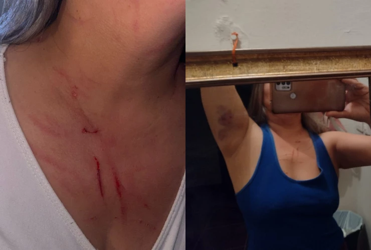 Mujer es agredida al sur de la capital