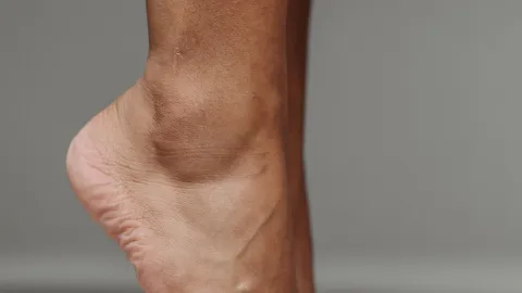 El secreto para eliminar las durezas de los talones de tus pies