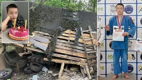 Niño fue quemado vivo por envidia de amigos tras ser campeón de judo