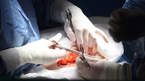 Transplante de corazón