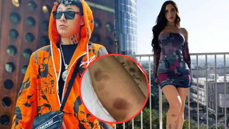 Alemán es denunciado por su novia Akasha de violencia física